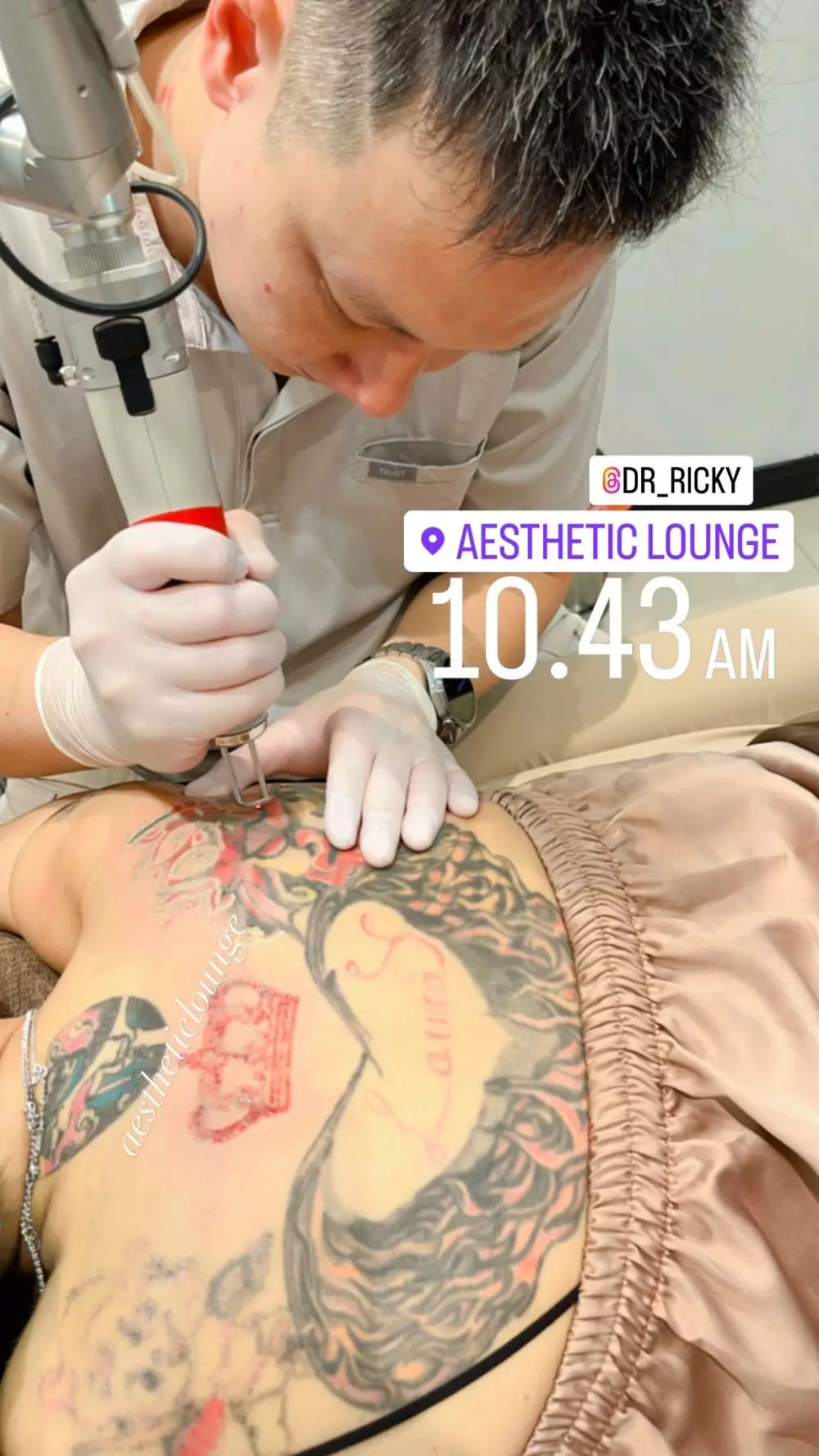 Nikita Mirzani hapus tato di punggung © Instagram Nikita Mirzani hapus tato di punggung © Instagram