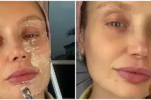 Tanpa aloe vera gel, wanita ini bagikan trik menghidrasi wajah kering pakai masker dari 3 bahan dapur