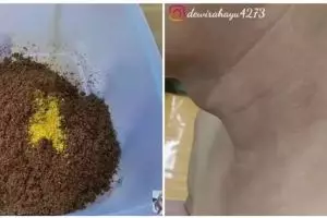 Bikin cerah dan bersih kembali, ini 11 cara atasi leher hitam berdaki tebal pakai campuran bahan alami