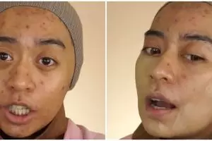 Bukti kekuatan makeup, wanita wajah penuh jerawat dirias flawless ini hasilnya mulus dan antidempul