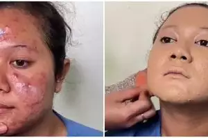 Transformasi makeup wanita wajah berjerawat jadi manten Jawa ini hasilnya mulus pol, bak beda orang