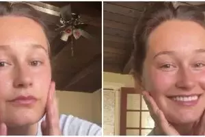 Tanpa scrub mahal, cara atasi komedo pakai madu dicampur 1 bahan dapur ini bikin wajah lebih mulus