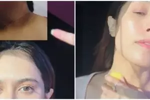 Bukan pakai kopi, trik atasi leher hitam berdaki agar cerah merata ini cuma dengan 2 bahan alami