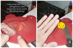 Bukan diolesi minyak, ini trik hilangkan rasa panas di tangan akibat cabai cuma pakai 1 bahan dapur