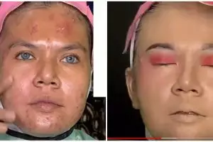 Wanita wajah berjerawat ini dirias MUA jadi pengantin modern, hasil akhirnya bikin bopeng tersamarkan