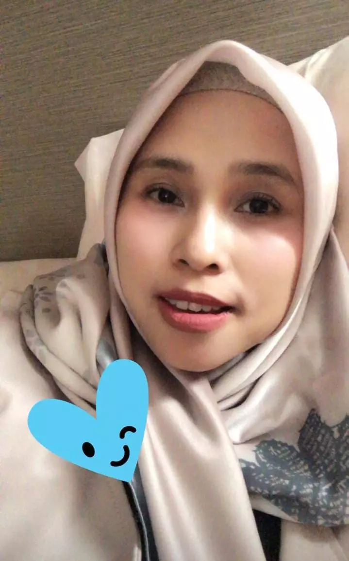 transformasi bos skincare Erlyanie Instagram