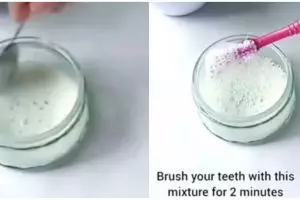 Tanpa scalling mahal, ini cara atasi gigi kuning dan penuh karang hanya dengan 1 bahan dapur