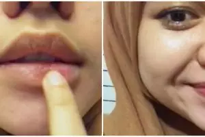 Tak perlu beli scrub mahal, cewek ini bagikan cara atasi bibir kering pecah-pecah pakai 3 bahan dapur