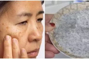 Tak cuma pakai yogurt, TikToker ini bagikan cara atasi flek hitam dengan tambahan 1 jenis biji-bijian