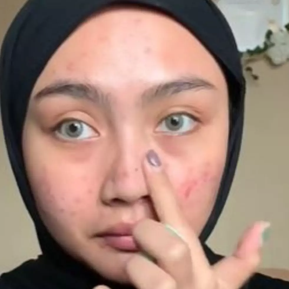 Transformasi makeup cewek kulit berjerawat rias wajah ala peach makeup, hasilnya flawless auto mulus