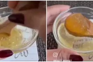 Tanpa perawatan mahal, ini trik redakan kemerahan di wajah akibat jerawat meradang pakai 2 bahan dapur