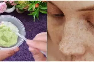 Usia 50-an terlihat 10 tahun lebih muda, ini cara mengatasi flek hitam pakai 1 jenis sayuran
