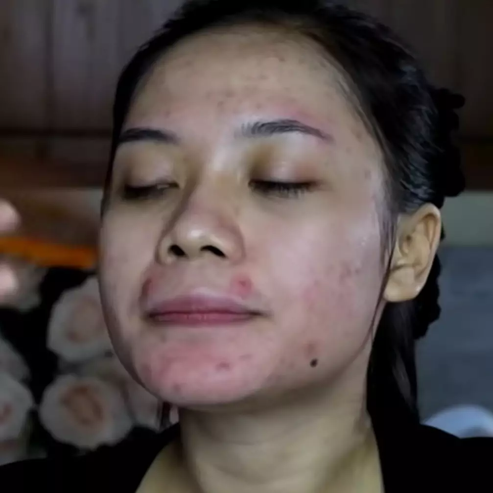 Kekuatan makeup sulap wajah penuh jerawat jadi tampak glowing ini hasilnya mulus tanpa dempul