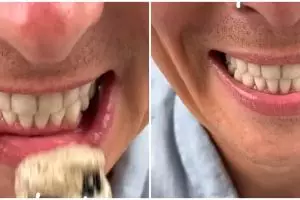 Putih dalam satu menit, ini cara ampuh membersihkan karang gigi pakai 1 bubuk minuman