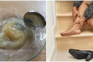 Tanpa perawatan di salon, ini cara mengatasi tumit kaki retak menghitam pakai 1 bumbu dapur