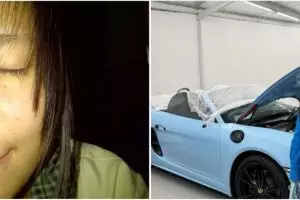 Mantan pejuang jerawat jadi bos skincare, 11 potret transformasi Valencia Nathania manglingi pol