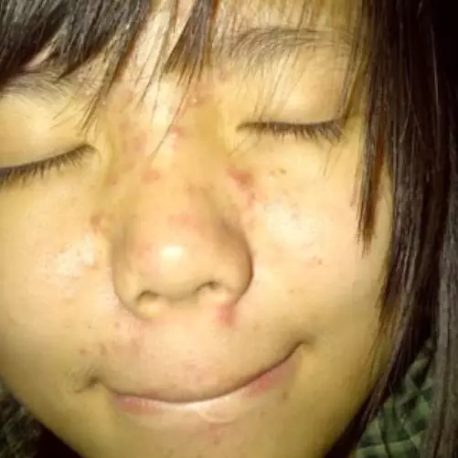 Mantan pejuang jerawat jadi bos skincare, 11 potret transformasi Valencia Nathania manglingi pol