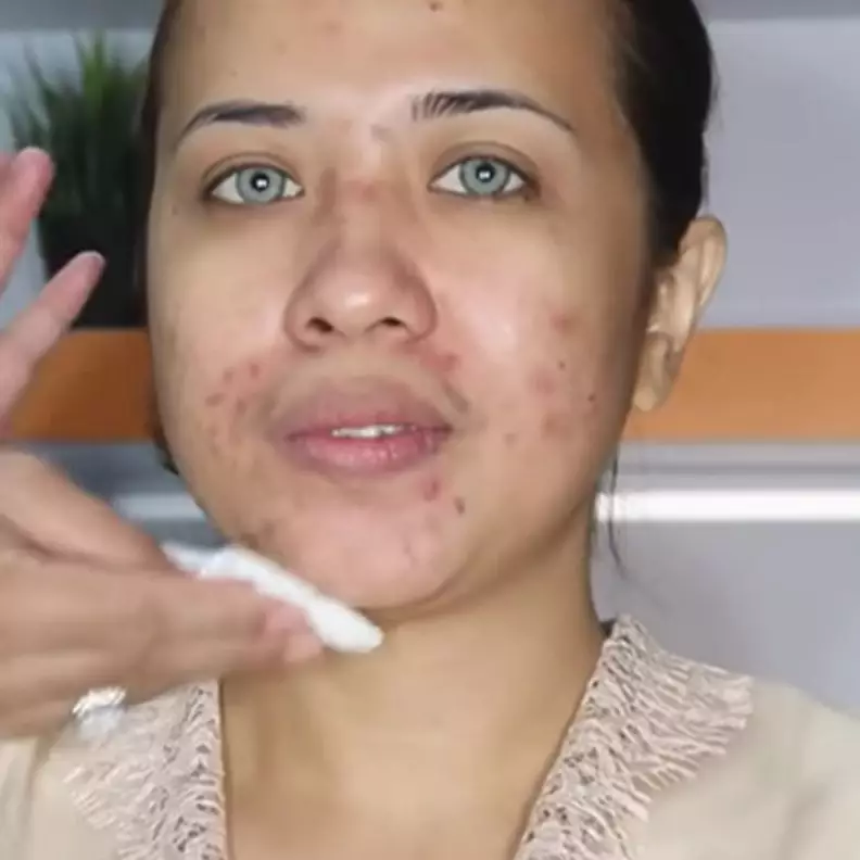 Transformasinya bikin melongo, pria ini sulap wajah pengantin bertekstur dan jerawat jadi bak barbie