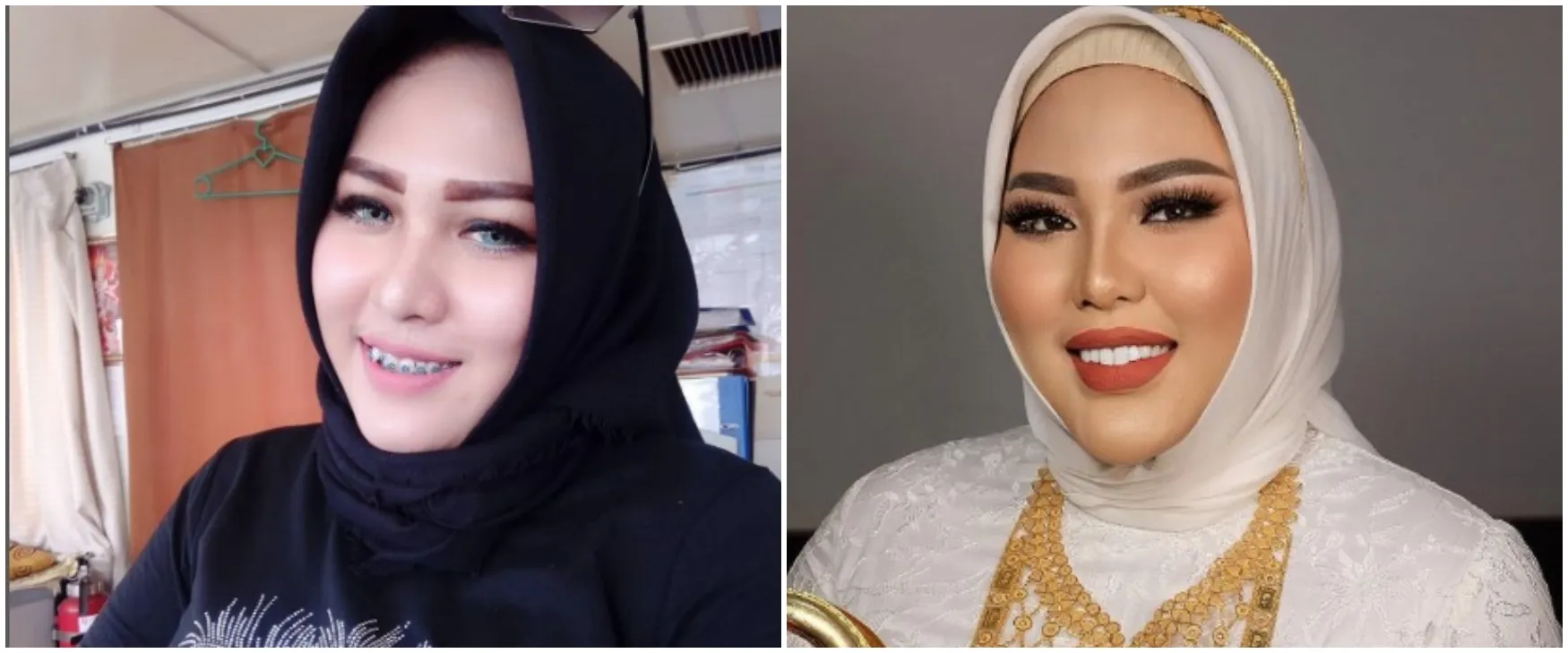 9 Potret bos skincare Mira Hayati sebelum vs sesudah pakai behel, parasnya yang kian tirus manglingi