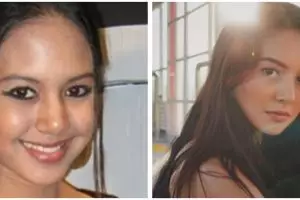 Wajah jadi kencang dan tak menua, potret 21 seleb sebelum dan sesudah suntik botoks ini manglingi