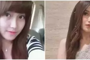 13 Potret penyanyi sebelum dan sesudah tanam benang, kini wajah Ayu Ting Ting bak artis Korea