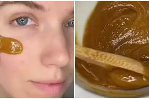 Tak perlu acne patch, TikToker ini bagikan cara atasi jerawat meradang pakai 3 bahan dapur