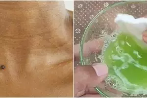 Tanpa masker pemutih, pria ini bagikan cara cerahkan leher hitam cuma pakai 2 jenis buah-buahan