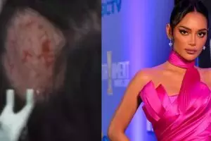 Gangguan kecemasan jadi awal autoimun, Erika Carlina alami kesemutan otak hingga kepala botak