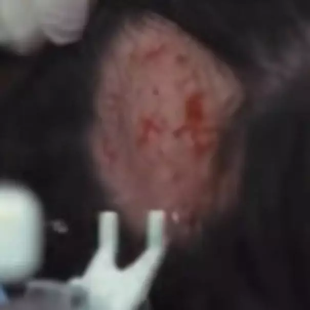 Gangguan kecemasan jadi awal autoimun, Erika Carlina alami kesemutan otak hingga kepala botak