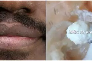 Tanpa kentang, beauty vlogger ini bagikan cara hempas kulit hitam di area mulut pakai 1 jenis tepung