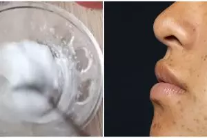 Nggak dicampur lemon, wanita ini tunjukkan cara hilangkan flek hitam pakai krim dari 1 bahan dapur