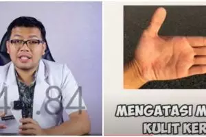 Bantu cegah penuaan dini, 7 makanan rekomendasi dokter ini bikin kulit kering jadi kenyal