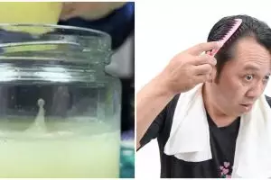 Tak dicampur teh hijau, ini cara mengatasi rambut botak depan pakai 1 bahan makanan