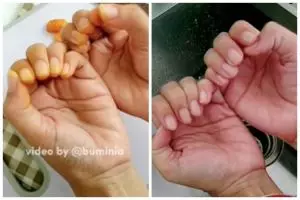 Bukan diolesi baking soda, ini cara cepat hilangkan noda kunyit di tangan pakai 1 bahan sederhana