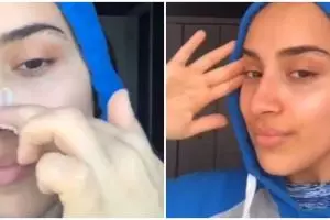 Nggak perlu beli nose strip, cewek ini bagikan cara hilangkan komedo di hidung pakai 1 bahan dapur