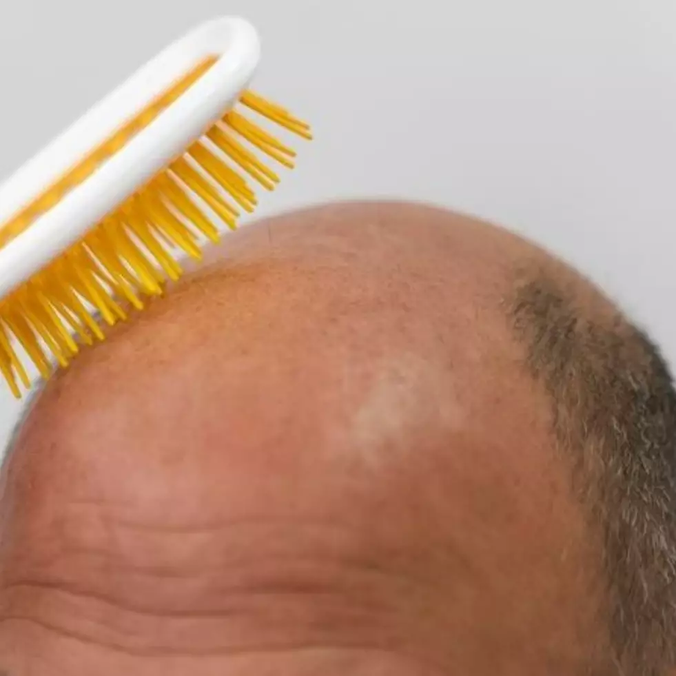 Bukan pakai tonic mahal, cara atasi rambut botak agar tumbuh subur ini cuma pakai 1 jenis daun