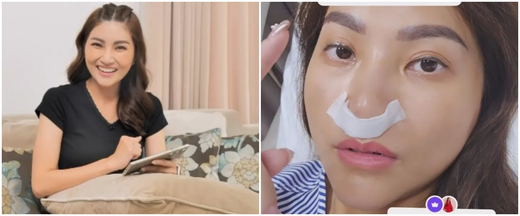 Sempat dikira operasi plastik hidung, Sarwendah beri penjelasan terkait penyakit yang dialaminya
