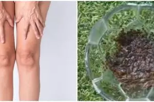 Nggak perlu kunyit dan kopi, ini cara cerahkan lutut hitam cuma pakai 2 bahan dapur