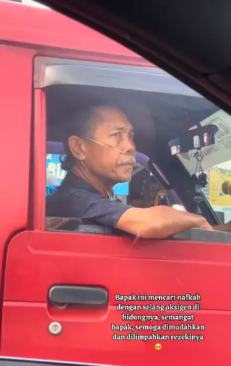 harus pakai selang oksigen © Instagram harus pakai selang oksigen © Instagram