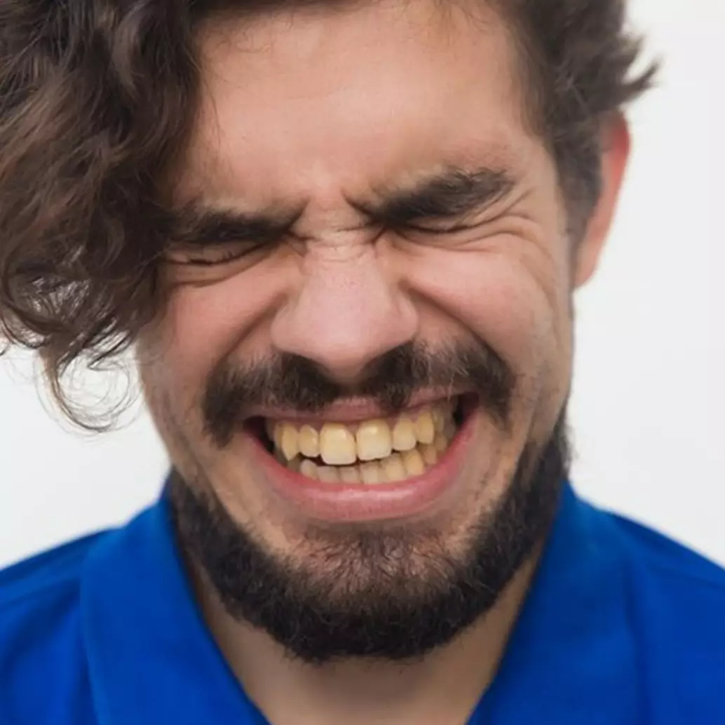 Hasilnya tampak dalam 3 hari, ini trik putihkan gigi kuning berkarang dengan 3 bahan dapur