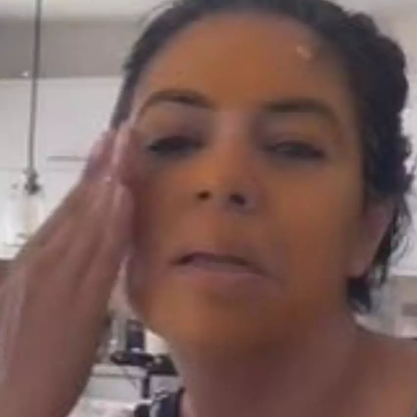 Bukan pakai krim dark spot, cewek ini bagikan cara pudarkan flek hitam hanya dengan 3 bahan alami