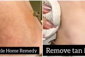 Bukan pakai scrub pemutih, cara atasi mata kaki hitam ala TikToker ini cuma butuh 3 bahan alami