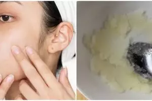 Sudah ditonton 396 ribu kali, cara bersihkan kotoran penyebab komedo putih cuma pakai 2 bahan alami