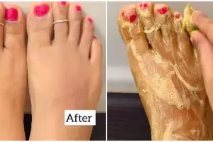 Tak dicampur tomat, wanita ini bagikan cara hilangkan kulit kaki belang pakai 1 bubuk minuman