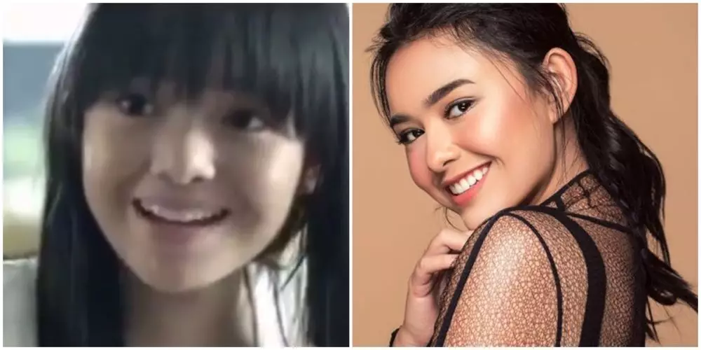 Amanda Manopo sebelum sesudah perawatan © berbagai sumber