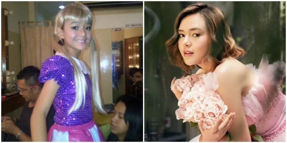 Amanda Manopo sebelum sesudah perawatan © berbagai sumber