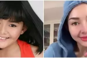 Wajah tirusnya manglingi, ini 11 potret Amanda Manopo sebelum vs sesudah jalani perawatan kecantikan