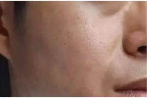 Tak gunakan kopi, ini cara mengecilkan pori-pori di wajah agar terlihat mulus cuma dengan 1 ampas buah