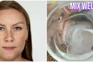 Tanpa laser, ini cara atasi flek hitam di wajah pakai minyak vitamin E ditambah 1 jenis bahan alami