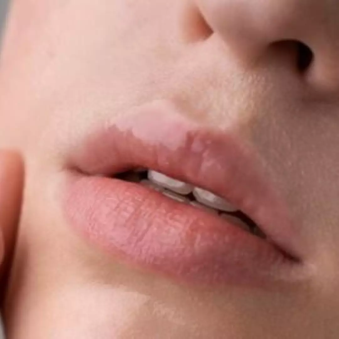 Tak perlu tambahan timun, ini trik membuat bibir merah ala wanita Korea hanya pakai 1 bahan rempah